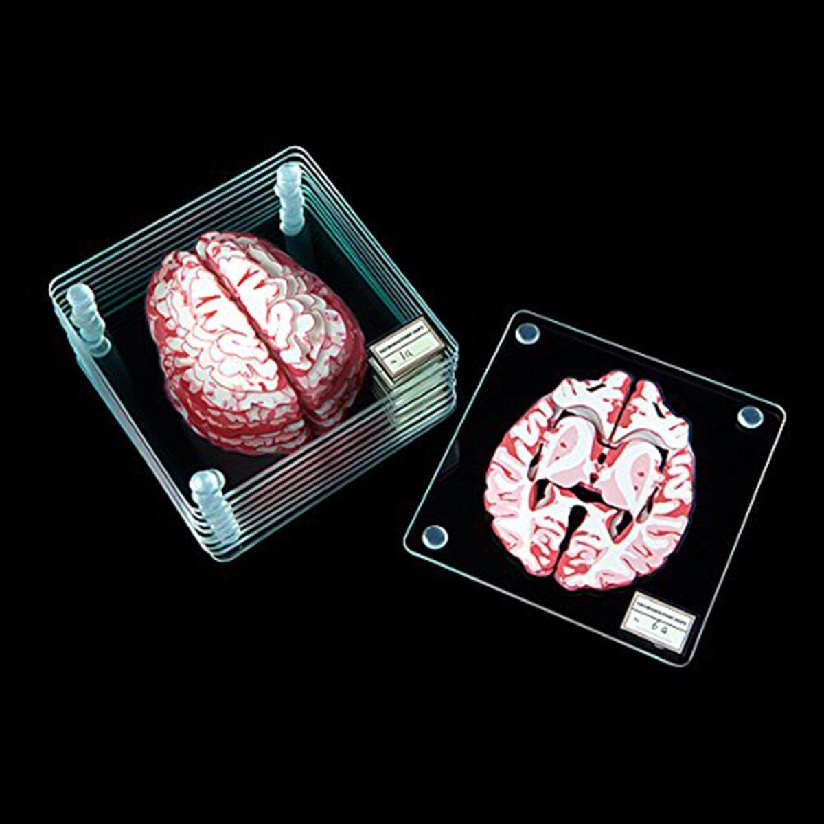 Brain Specimen 10-Piece Coaster Set